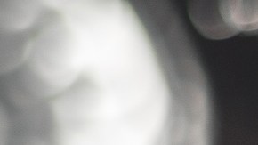 Aprueban primer medicamento no antipsicótico para la agitación en la enfermedad de Alzheimer