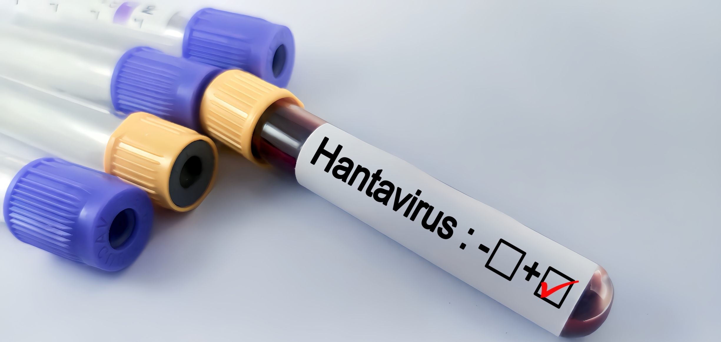 Positivo Hantavirus