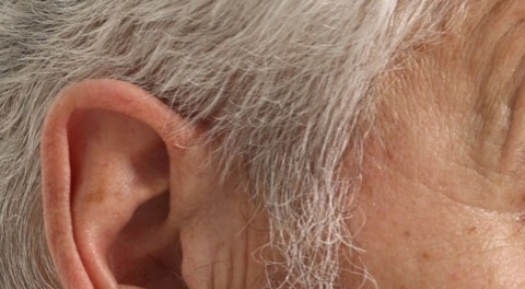 Aunque suene parecido, no es lo mismo: diferencias entre artritis y artrosis