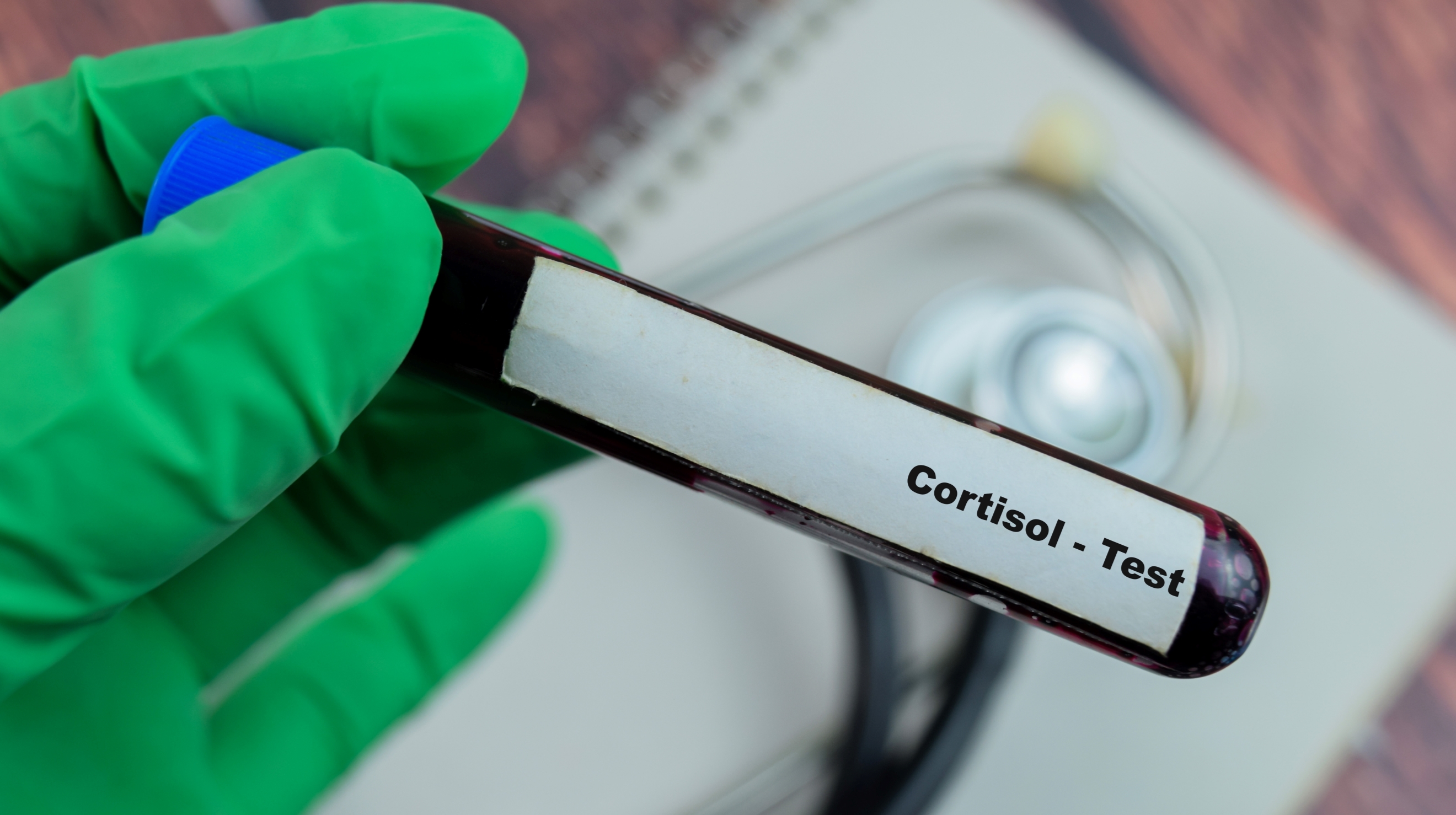 Golpe al cortisol: formas para reducir el estrés crónico y mejorar la energía