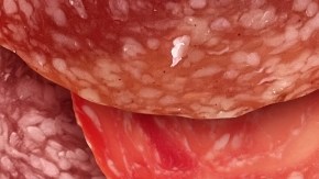 Una sola ración de jamón, salchicha o tocineta al día se relaciona con un mayor riesgo de cáncer de estómago