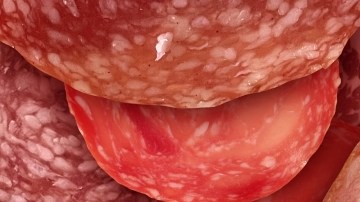 Una sola ración de jamón, salchicha o tocineta al día se relaciona con un mayor riesgo de cáncer de estómago
