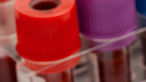 Frasco de biotina junto a tubos de sangre y resultados de laboratorio sobre una mesa médica
