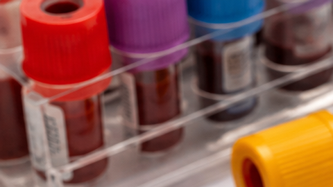 Frasco de biotina junto a tubos de sangre y resultados de laboratorio sobre una mesa médica