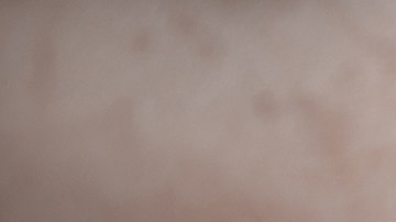 Al morderte las uñas puedes sufrir lesiones constantes que facilitan la aparición de infecciones causadas por bacterias y otros microorganismos presentes en las manos.