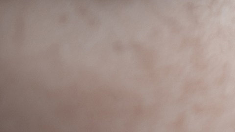 Al morderte las uñas puedes sufrir lesiones constantes que facilitan la aparición de infecciones causadas por bacterias y otros microorganismos presentes en las manos.