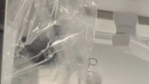Tumores cerebrales "benignos": ni son tan inocuos ni se libran de los tratamientos