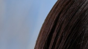 Conoce 5 antialérgicos naturales antes de recurrir a los fármacos