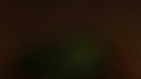 Claves sobre la "diarrea explosiva" que mantiene en vilo a personas en más de 30 estados de EE.UU.