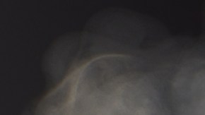 ¿Es verdad que el vapeo reviste riesgo de cáncer oral?