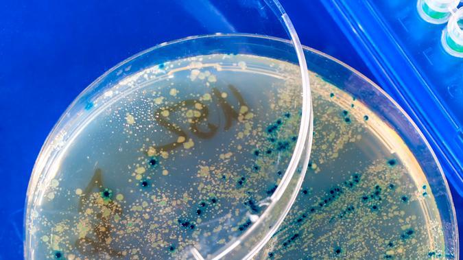 La IA podría crear virus que podrían ayudar contra bacterias resistentes, pero también existe el riesgo de que generen virus nocivos.