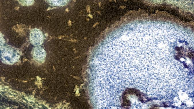 Los bacteriófagos atacan a bacterias como la Escherichia coli (foto).