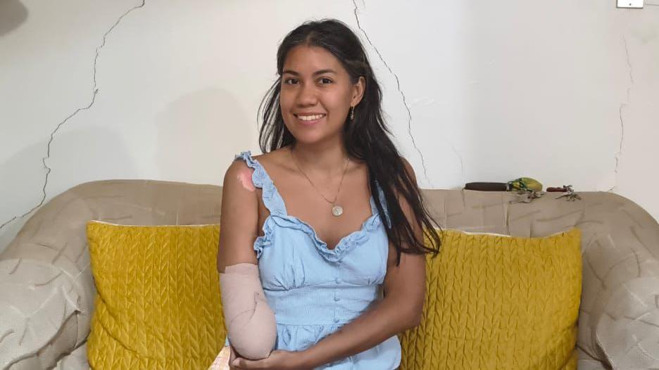 El testimonio de Nayarit Colmenares, la mujer amputada tras los terremotos en Venezuela