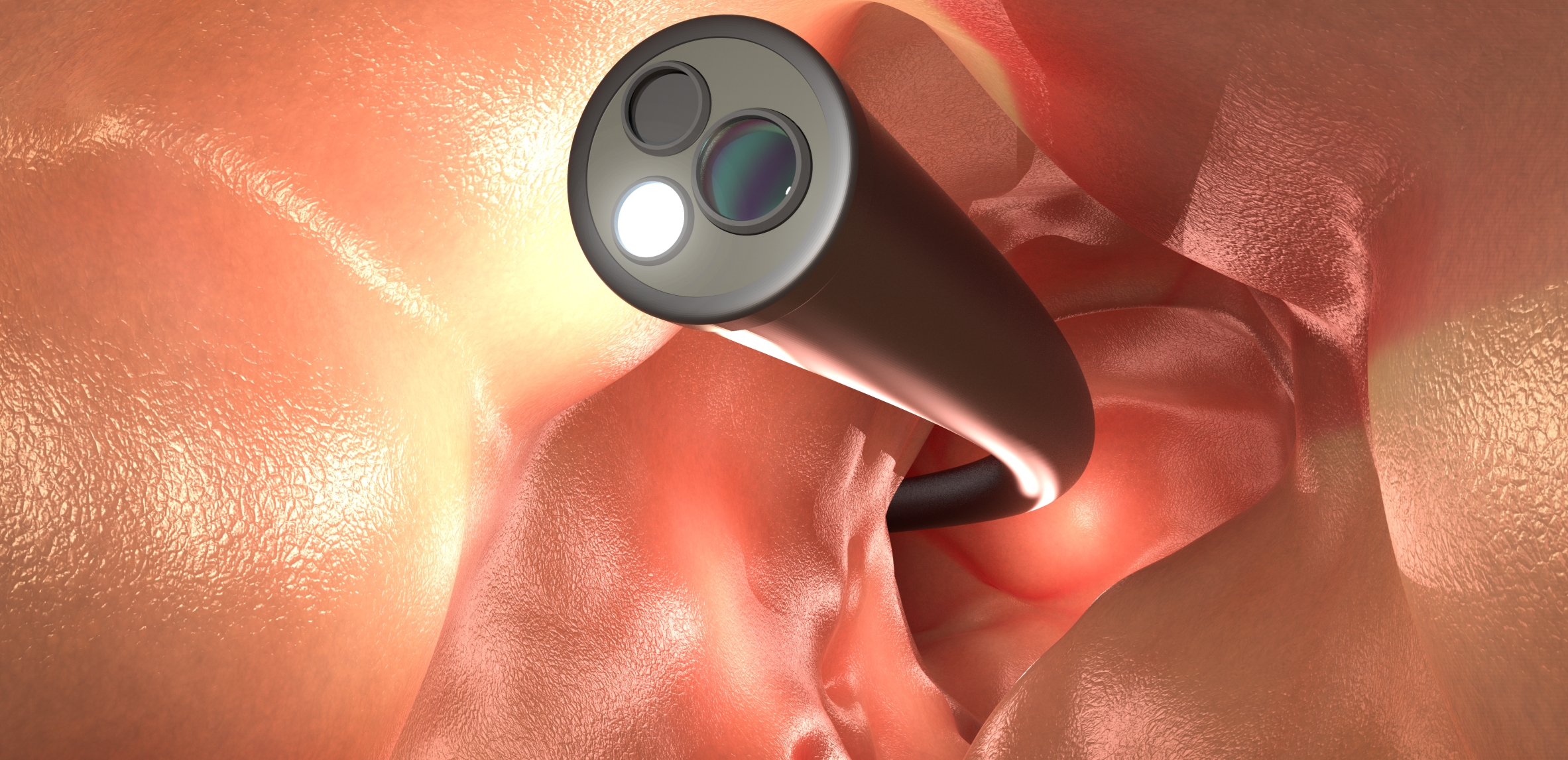Desarrollan vacunas prometedoras para interceptar el cáncer de colon