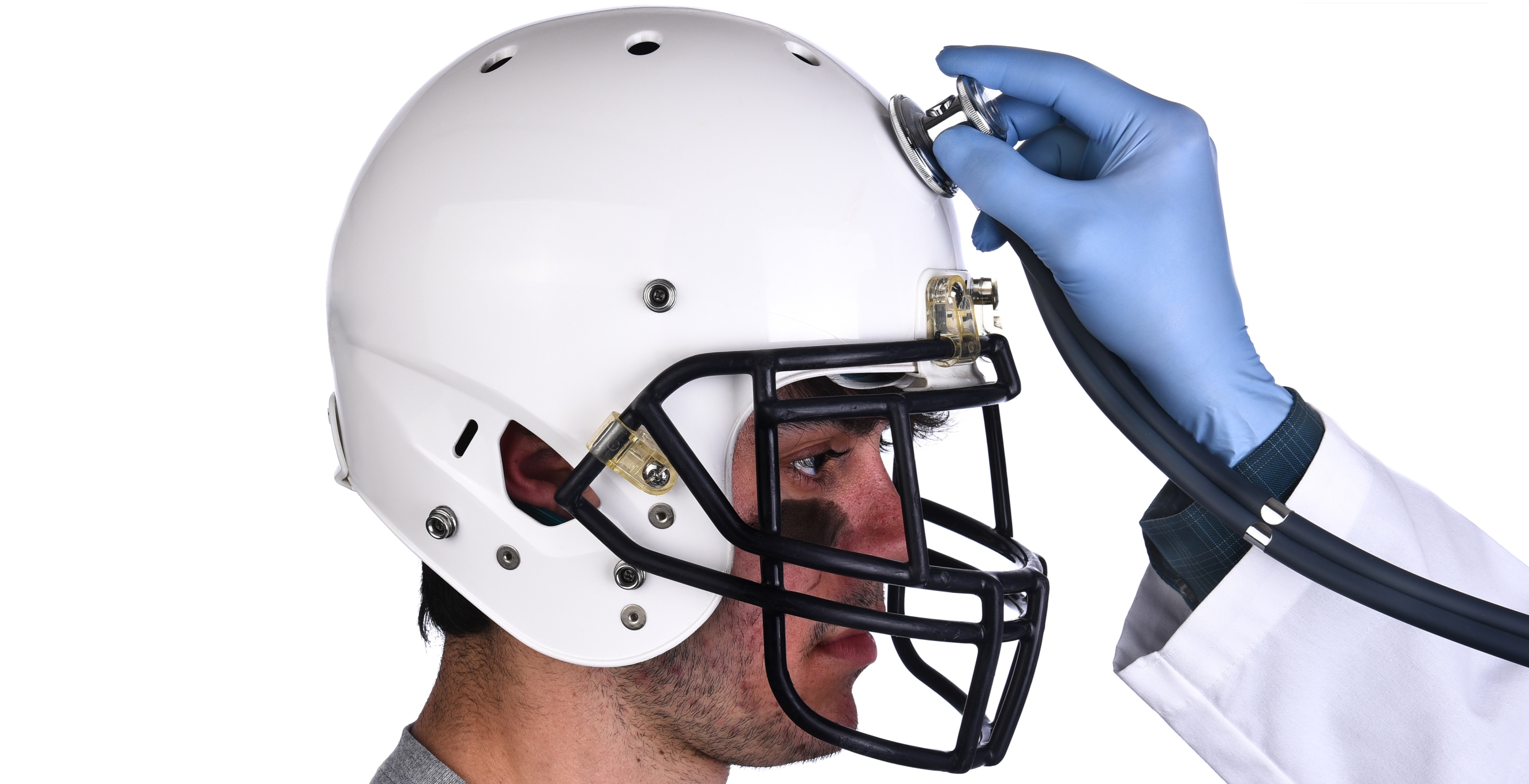 Más de la encefalopatía traumática crónica: uno de cada cuatro exjugadores de la NFL la padece
