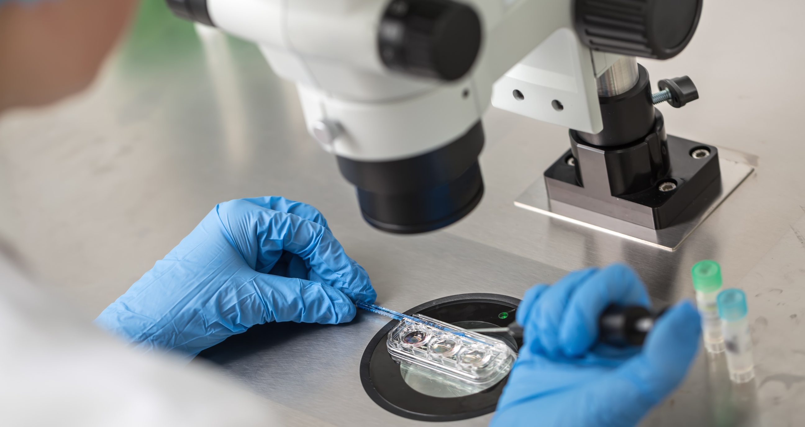 Entendiendo la estimulación ovárica: ¿qué debes saber sobre los tratamientos de fertilidad?