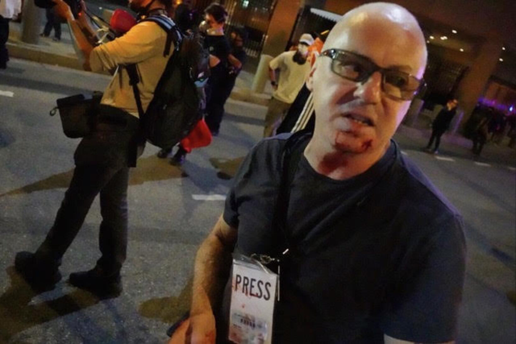 Fotoperiodista demanda a la ciudad de Los Ángeles por agresión policial durante protesta contra ICE
