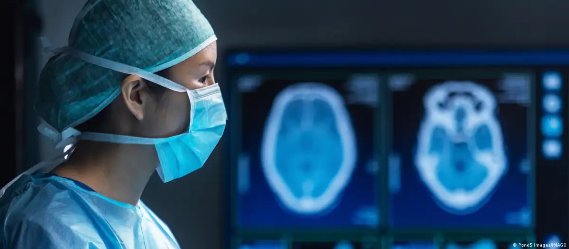 Una cirugía cerebral inédita demuestra el potencial de la IA en tiempo real