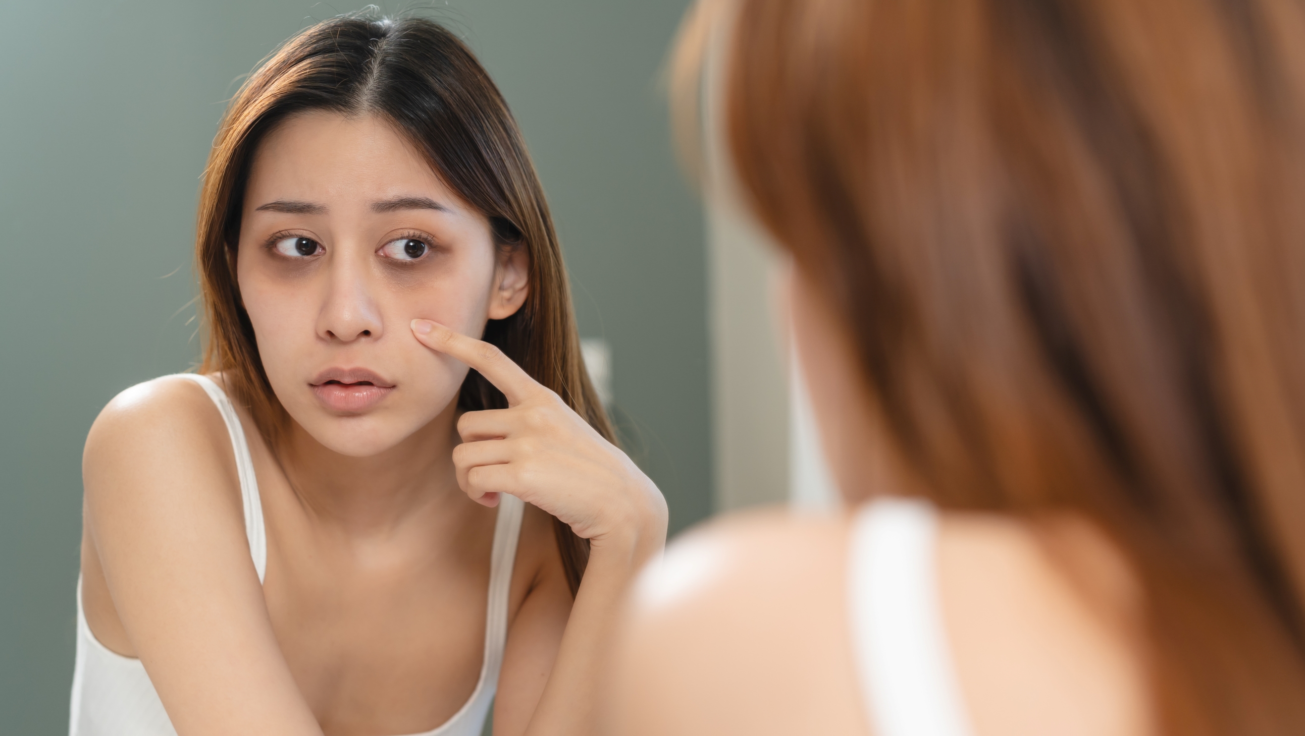 Ojeras y fatiga: las señales que el cuerpo envía cuando falta hierro