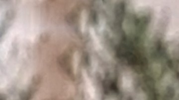 El papa León XIV tiene un nódulo en el pulmón: ¿qué tan grave puede ser este tipo de afección?
