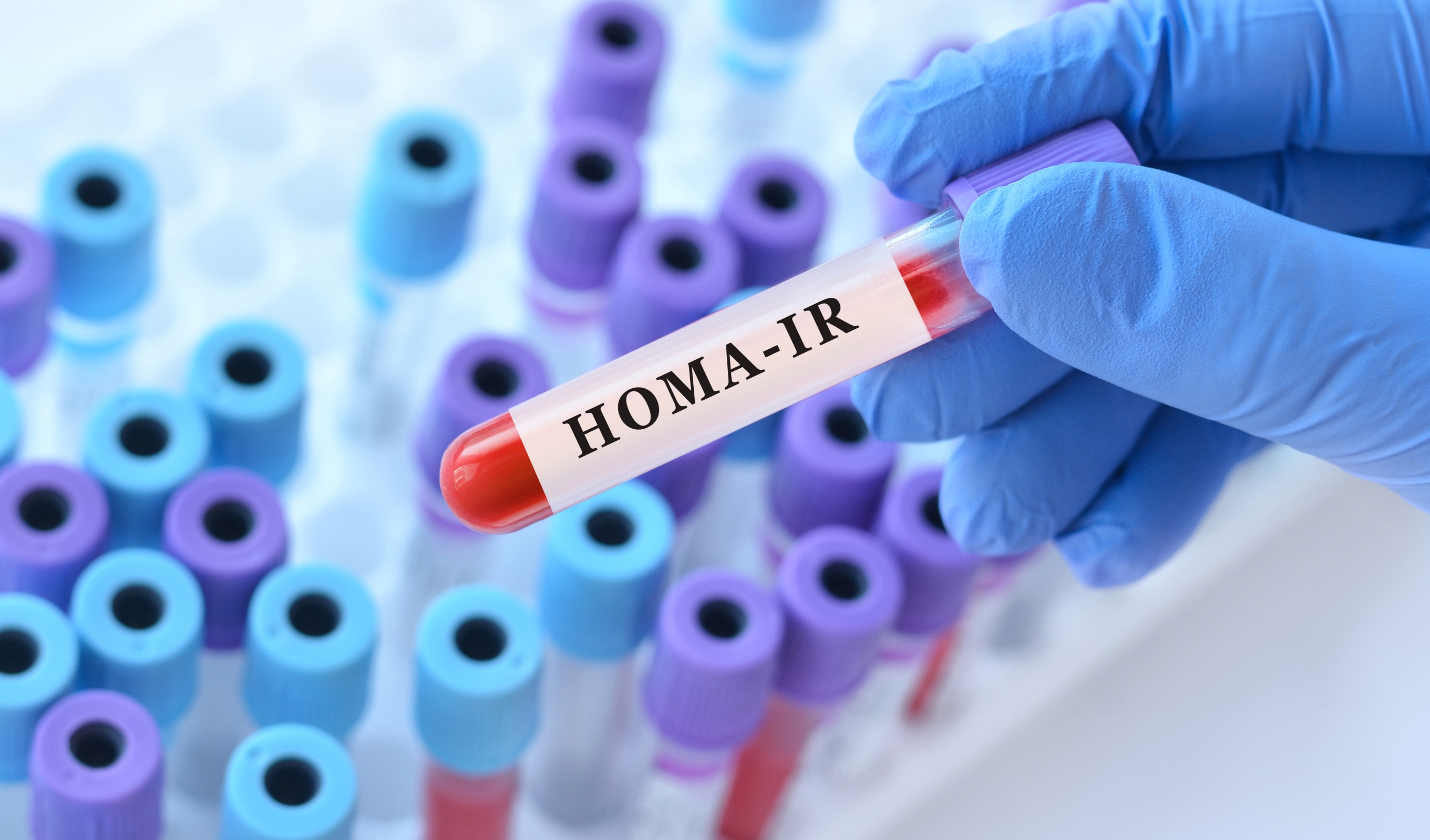 Aunque menos común, la diabetes tipo 3 es un riesgo: ¿cómo diferenciarla?