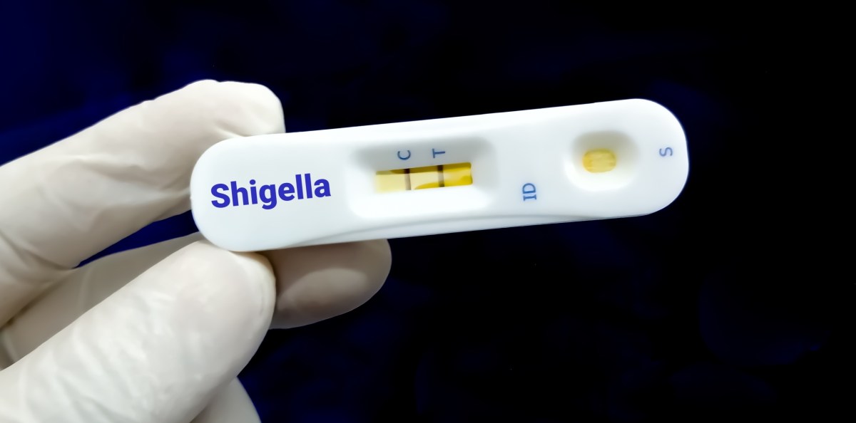 Diarrea con sangre y fiebre: el contacto sexual como transmisor de shigelosis